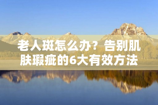 老人斑怎么办？告别肌肤瑕疵的6大有效方法