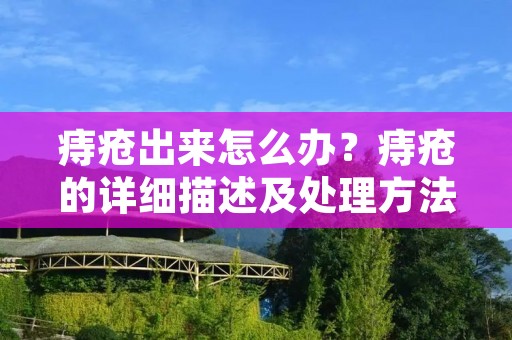 痔疮出来怎么办?痔疮的详细描述及处理方法 痔疮出来怎么办?痔疮的详细描述及处理方法