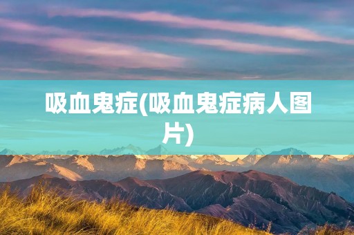 吸血鬼症(吸血鬼症病人图片) 吸血鬼症(吸血鬼症病人图片)