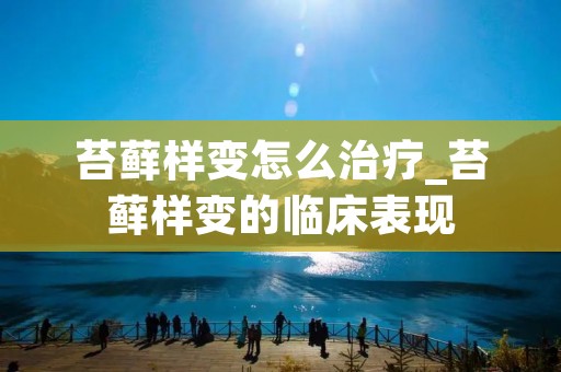 苔藓样变怎么治疗_苔藓样变的临床表现