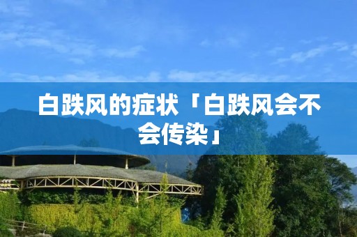 白跌风的症状「白跌风会不会传染」