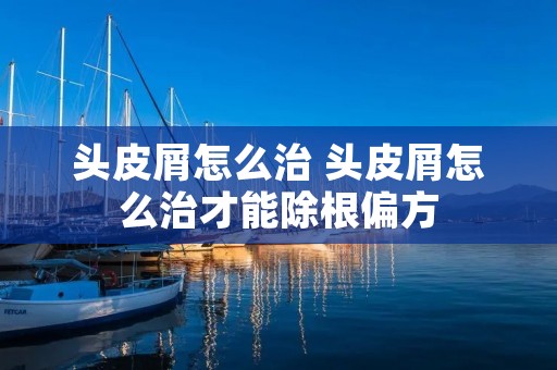 头皮屑怎么治 头皮屑怎么治才能除根偏方