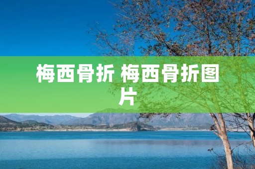 梅西骨折 梅西骨折图片