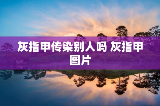 灰指甲传染别人吗 灰指甲图片 灰指甲传染别人吗 灰指甲图片