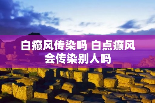 白癫风传染吗 白点癫风会传染别人吗