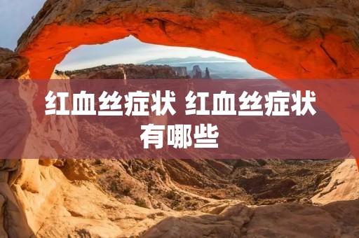 红血丝症状 红血丝症状有哪些