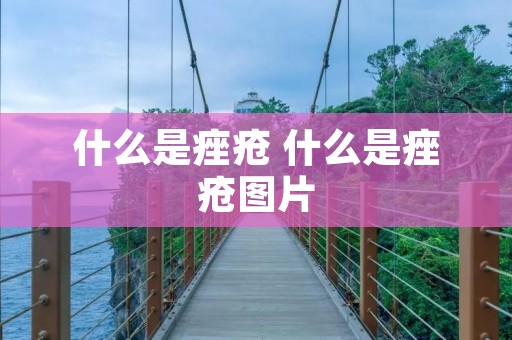 什么是痤疮 什么是痤疮图片