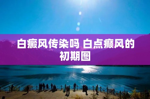 白癜风传染吗 白点癫风的初期图 白癜风传染吗 白点癫风的初期图