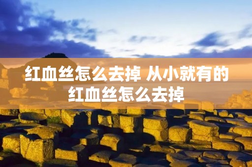 红血丝怎么去掉 从小就有的红血丝怎么去掉