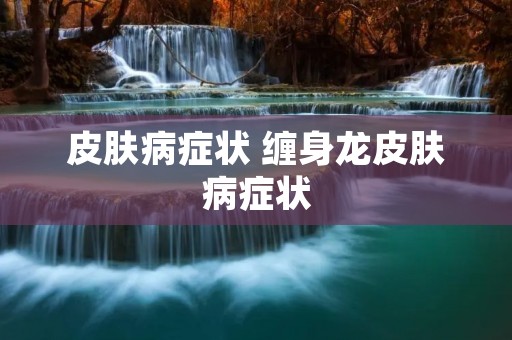皮肤病症状 缠身龙皮肤病症状