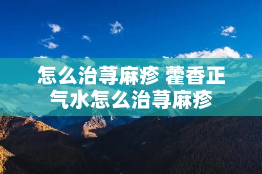 怎么治荨麻疹 藿香正气水怎么治荨麻疹
