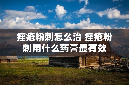 痤疮粉刺怎么治 痤疮粉刺用什么药膏最有效 痤疮粉刺怎么治 痤疮粉刺用什么药膏最有效
