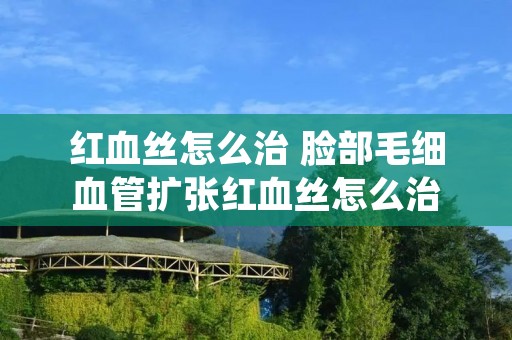 红血丝怎么治 脸部毛细血管扩张红血丝怎么治