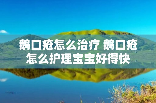 鹅口疮怎么治疗 鹅口疮怎么护理宝宝好得快
