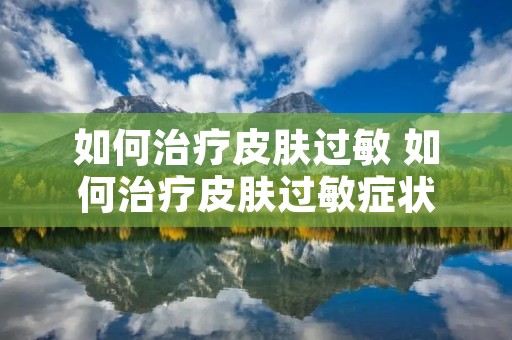 如何治疗皮肤过敏 如何治疗皮肤过敏症状