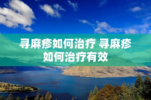 寻麻疹如何治疗 寻麻疹如何治疗有效
