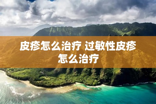皮疹怎么治疗 过敏性皮疹怎么治疗