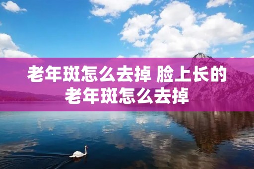 老年斑怎么去掉 脸上长的老年斑怎么去掉 老年斑怎么去掉 脸上长的老年斑怎么去掉