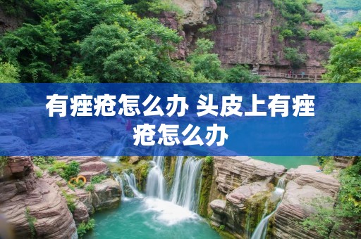 有痤疮怎么办 头皮上有痤疮怎么办