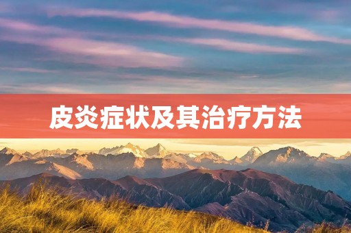 皮炎症状及其治疗方法 皮炎症状及其治疗方法